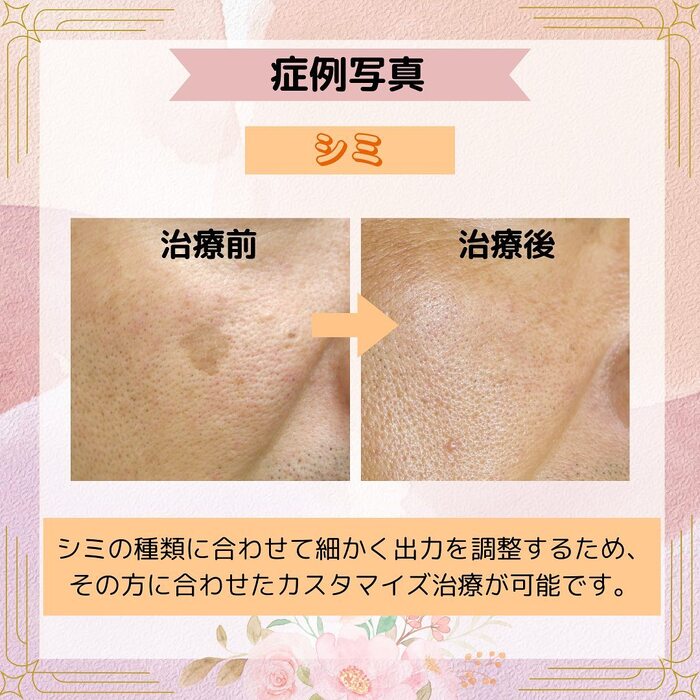 画像447